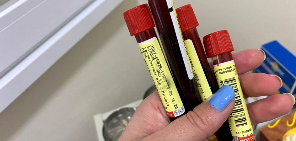 Cidade de S&atilde;o Paulo registra primeiro caso positivo para a variante Delta