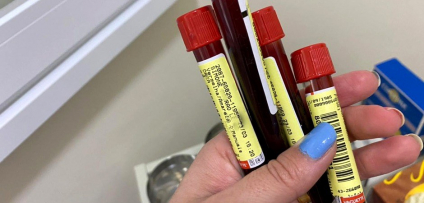 Cidade de São Paulo registra primeiro caso positivo para a variante Delta